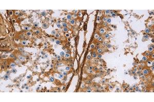 Immunohistochemistry of paraffin-embedded Human testis using Caldesmon Polyclonal Antibody at dilution of 1:40 (Caldesmon antibody)