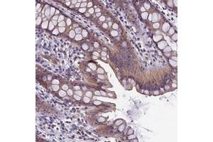 Immunohistochemical staining of human rectum with CACNG8 polyclonal antibody  shows moderate cytoplasmic positivity in glandular cells. (CACNG8 antibody)