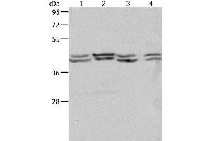 Western Blot analysis of Hela, 293T, NIH/3T3 and Jurkat cell using PSMD6 Polyclonal Antibody at dilution of 1:650 (PSMD6 antibody)