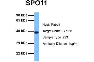 Host: Rabbit Target Name: SPO11 Sample Tissue: Human 293T Antibody Dilution: 1. (SPO11 antibody  (N-Term))
