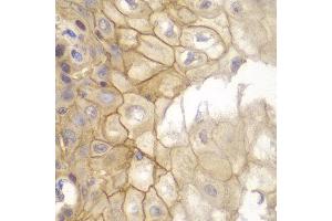 Immunohistochemistry of paraffin-embedded human esophageal using IL7R antibody at dilution of 1:100 (40x lens). (IL7R antibody)