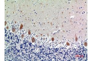 Immunohistochemical analysis of paraffin-embedded human-brain, antibody was diluted at 1:100 (KIR3DL1 antibody  (N-Term))