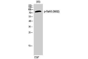 Western Blotting (WB) image for anti-B-Raf proto-oncogene, serine/threonine kinase (BRAF) (pSer602) antibody (ABIN3173267) (BRAF antibody  (pSer602))