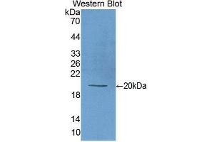 Western Blotting (WB) image for anti-Matrix Metallopeptidase 9 (Gelatinase B, 92kDa Gelatinase, 92kDa Type IV Collagenase) (MMP9) antibody (FITC) (ABIN1173111) (MMP 9 antibody  (FITC))
