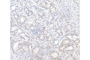 Immunohistochemistry (IHC) image for anti-BRCA1 Associated Protein-1 (Ubiquitin Carboxy-terminal Hydrolase) (BAP1) (AA 679-729) antibody (ABIN7454810)
