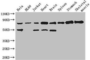 Western Blot Positive WB detected in: Hela whole cell lysate, HL60 whole cell lysate, Jurkat whole cell lysate, Mouse heart tissue, Mouse brain tissue, Mouse spleen tissue, Mouse stomach tissue, Mouse skeletal muscle tissue All lanes: SENP1 antibody at 2. (SENP1 antibody  (AA 63-214))
