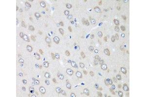 Immunohistochemistry of paraffin-embedded Rat brain using RPN2 Polyclonal Antibody at dilution of 1:100 (40x lens). (Ribophorin II antibody)