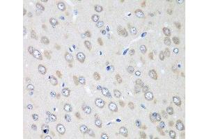 Immunohistochemistry of paraffin-embedded Rat brain using RPN2 Polyclonal Antibody at dilution of 1:100 (40x lens).