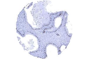 Strong nuclear p63 positivity in basal cells of prostate glands (Recombinant TCP1 alpha/CCTA antibody  (AA 600-680))