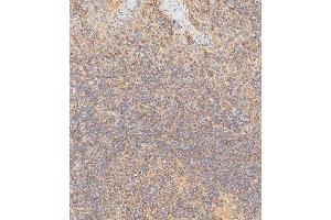 Immunohistochemistry (Paraffin-embedded Sections) (IHC (p)) image for anti-Major Histocompatibility Complex, Class I, B (HLA-B) (AA 62-90), (N-Term) antibody (ABIN652557)