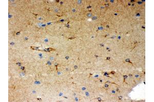 Immunohistochemistry (IHC) image for anti-SHC (Src Homology 2 Domain Containing) Transforming Protein 1 (SHC1) (AA 536-564), (C-Term) antibody (ABIN3043923)