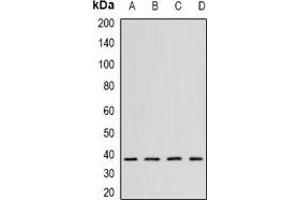 Western blot analysis of CK2 alpha expression in K562 (A), Hela (B), mouse testis (C), mouse brain (D) whole cell lysates. (CSNK2A1/CK II alpha antibody)