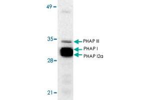 Western blot analysis of ANP32A expression in human Raji cell lysate with ANP32A polyclonal antibody  at 1 ug/mL . (PHAP1 antibody  (N-Term))