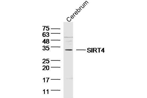 SIRT4 antibody  (AA 51-150)