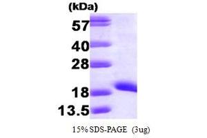 SDS-PAGE (SDS) image for Non-Metastatic Cells 1, Protein (NM23A) Expressed in (NME1) (AA 1-152) protein (ABIN666785) (NME1 Protein (AA 1-152))