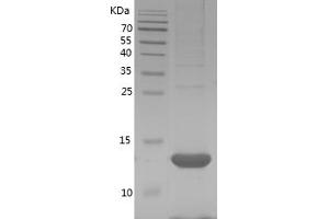 Western Blotting (WB) image for Serum Amyloid A (SAA) (AA 18-122) protein (His tag) (ABIN7281770) (SAA Protein (AA 18-122) (His tag))