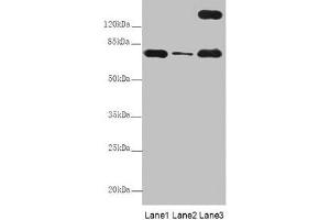 Western Blot All lanes: TTC12 antibody at 8 μg/mL Lane 1: Mouse large intestine tissue Lane 2: Mouse small intestine tissue Lane 3: HepG2 whole cell lysate Secondary Goat polyclonal to rabbit IgG at 1/10000 dilution Predicted band size: 79, 82 kDa Observed band size: 79, 170 kDa (TTC12 antibody  (AA 1-260))