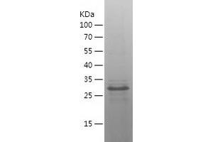 Western Blotting (WB) image for Caudal Type Homeobox 2 (CDX2) (AA 109-313) protein (His tag) (ABIN7283134) (CDX2 Protein (AA 109-313) (His tag))