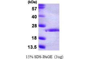 SDS-PAGE (SDS) image for Fibroblast Growth Factor 10 (FGF10) (AA 38-208) protein (His tag) (ABIN668016) (FGF10 Protein (AA 38-208) (His tag))