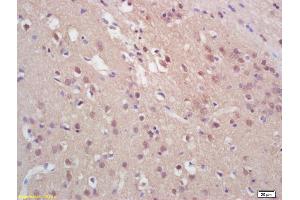 Formalin-fixed and paraffin embedded rat brain labeled with Rabbit Anti Phospho-Histone H3 (Ser28) Polyclonal Antibody, Unconjugated (ABIN742568) at 1:200 followed by conjugation to the secondary antibody and DAB staining (Histone 3 antibody  (pSer28))