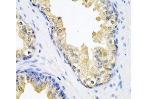 Immunohistochemistry of paraffin-embedded Human prostate using SPINT2 Polyclonal Antibody at dilution of 1:200 (40x lens). (SPINT2 antibody)