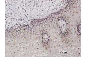 Immunoperoxidase of purified MaxPab antibody to TAF7 on formalin-fixed paraffin-embedded human esophagus. (TAF7 antibody  (AA 1-349))