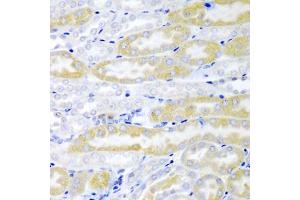 Immunohistochemistry of paraffin-embedded mouse kidney using FABP6 antibody (ABIN5974154) at dilution of 1/200 (40x lens). (FABP6 antibody)