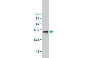 Western Blot detection against Immunogen (36. (Exportin 2 antibody  (AA 872-971))