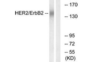 Western blot analysis of extracts from HuvEc cells, using HER2 (Ab-686) Antibody. (ErbB2/Her2 antibody  (AA 661-710))