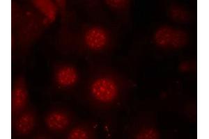 Immunofluorescence staining of methanol-fixed MCF7 cells using AFX(Phospho-Ser197) Antibody. (FOXO4 antibody  (pSer197))