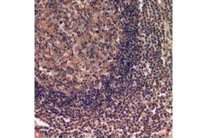 Immunohistochemical analysis of IDH3 alpha staining in human lymph gland formalin fixed paraffin embedded tissue section. (IDH3A antibody)