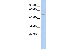 WB Suggested Anti-TBC1D10C Antibody Titration: 0. (Carabin antibody  (N-Term))