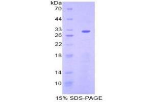 SDS-PAGE analysis of Mouse ENTPD1 Protein.