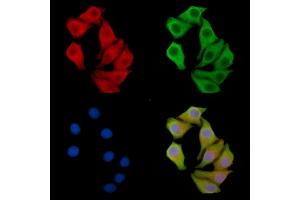 RNF87 Antibody staining Hela cells by IF/ICC.