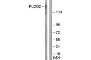 Western blot analysis of extracts from Raw264. (Phospholipase C gamma 2 antibody  (AA 1186-1235))