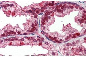 Human Prostate; Immunohistochemistry with Human Prostate lysate tissue at an antibody concentration of 5. (NFIX antibody  (Middle Region))