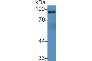Detection of PPARgC1a in Rat Serum using Polyclonal Antibody to Peroxisome Proliferator Activated Receptor Gamma Coactivator 1 Alpha (PPARgC1a) (PPARGC1A antibody  (AA 588-773))