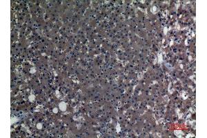 Immunohistochemistry (IHC) analysis of paraffin-embedded Human Liver, antibody was diluted at 1:100. (ALDH1A1 antibody  (N-Term))