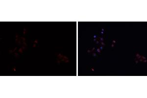 ABIN6276742 staining HEPG2 cells by IF/ICC. (SCARB1 antibody  (Internal Region))