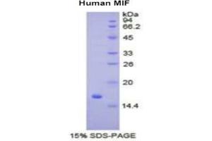 SDS-PAGE of Protein Standard from the Kit (Highly purified E. (MIF ELISA Kit)