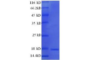 SDS-PAGE (SDS) image for Major Urinary Protein 19 (MUP19) (AA 32-181) protein (His tag) (ABIN4974890)