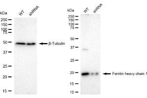 Western blotting analysis using Ferritin heavy chain 1 antibody (ABIN7798596).