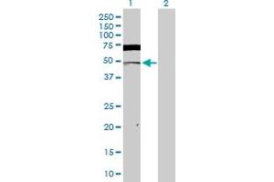 Western Blot analysis of CSNK2A1 expression in transfected 293T cell line by CSNK2A1 MaxPab polyclonal antibody.