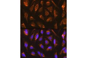 Immunofluorescence (IF) image for anti-Transcription Factor A, Mitochondrial (TFAM) antibody (ABIN3023685)