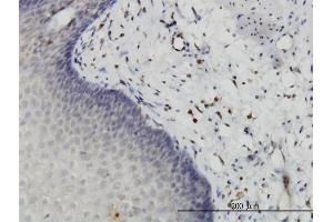 Immunoperoxidase of monoclonal antibody to HIPK2 on formalin-fixed paraffin-embedded human esophagus. (HIPK2 antibody  (AA 961-1065))