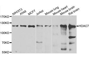 Western blot analysis of extracts of various cell lines, using HDAC7 antibody. (HDAC7 antibody)
