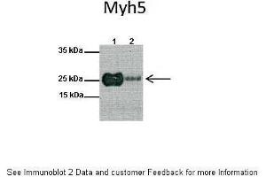 Lanes:   1: Mouse heart lysate, 2: Mouse skeletal muscle lysate  Primary Antibody Dilution:   1:1000  Secondary Antibody:   Anti-rabbit HRP  Secondary Antibody Dilution:   1:10000  Gene Name:   MYF5  Submitted by:   Anonymous (MYF5 antibody  (N-Term))