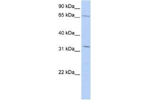 WB Suggested Anti-TRIM22 Antibody Titration:  0.