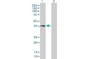 Western Blot analysis of CHI3L2 expression in transfected 293T cell line by CHI3L2 MaxPab polyclonal antibody. (CHI3L2 antibody  (AA 1-390))