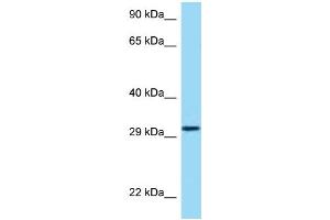 WB Suggested Anti-HRH4 Antibody Titration: 1. (HRH4 antibody  (Middle Region))